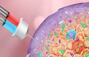 پیشگیری از رشد تومورهای سرطانی با داربست هیدروژل